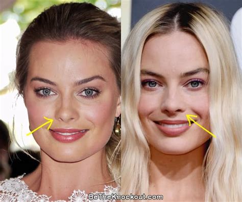 margot robbie before and after surgery|Margot Robbie: Before And After Beauty。